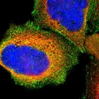 Immunofluorescent staining of human cell line A-431 shows localization to plasma membrane, cytosol & focal adhesion sites.