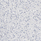 Immunohistochemical staining of human liver shows no positivity in hepatocytes as expected.