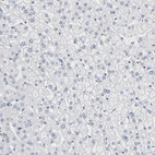 Immunohistochemical staining of human liver shows no positivity in hepatocytes as expected.