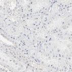 Immunohistochemical staining of human kidney shows no positivity in cells in tubules as expected.