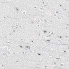 Immunohistochemical staining of human cerebral cortex shows very weak positivity in neurons.
