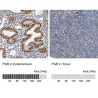 Anti-PGR Antibody