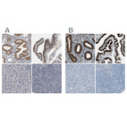 Immunohistochemical staining of human endometrium, fallopian tube, pancreas and tonsil using Anti-PGR antibody HPA004751 (A) shows similar protein distribution across tissues to independent antibody HPA008428 (B).