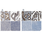 Anti-PGR Antibody