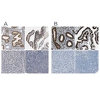 Immunohistochemical staining of human endometrium, fallopian tube, pancreas and tonsil using Anti-PGR antibody HPA004751 (A) shows similar protein distribution across tissues to independent antibody HPA008428 (B).