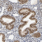 Anti-PGR Antibody