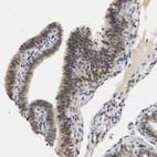 Immunohistochemical staining of human fallopian tube shows moderate nuclear positivity in glandular cells.