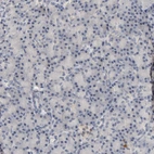 Immunohistochemical staining of human pancreas shows no positivity in exocrine glandular cells as expected.