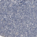 Immunohistochemical staining of human tonsil shows no positivity in non-germinal center cells as expected.