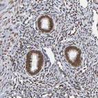 Immunohistochemical staining of human endometrium shows strong nuclear positivity in glandular cells.