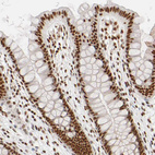 Immunohistochemical staining of human colon shows strong nuclear positivity in glandular cells.