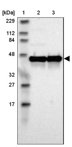 Lane 1: Marker [kDa] 229, 112, 84, 48, 32, 27, 17_br/_Lane 2: Human cell line RT-4_br/_Lane 3: Human cell line U-251MG sp