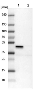 Lane 1: NIH-3T3 cell lysate (Mouse embryonic fibroblast cells)_br/_Lane 2: NBT-II cell lysate (Rat Wistar bladder tumour cells)