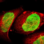 Immunofluorescent staining of human cell line A-431 shows localization to nucleus.