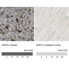 Anti-NGFR Antibody