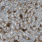 Immunohistochemical staining of human spleen shows strong membranous positivity.