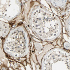 Immunohistochemical staining of human testis shows strong membranous positivity in peritubular myoid cells.