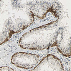 Anti-NGFR Antibody