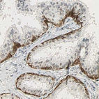 Immunohistochemical staining of human prostate shows moderate cytoplasmic positivity in glandular cells.