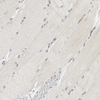 Immunohistochemical staining of human skeletal muscle shows no positivity in myocytes as expected.