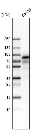 Western blot analysis in human cell line RH-30.