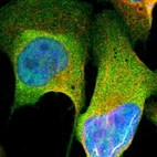 Immunofluorescent staining of human cell line U-2 OS shows localization to nucleoplasm & plasma membrane.