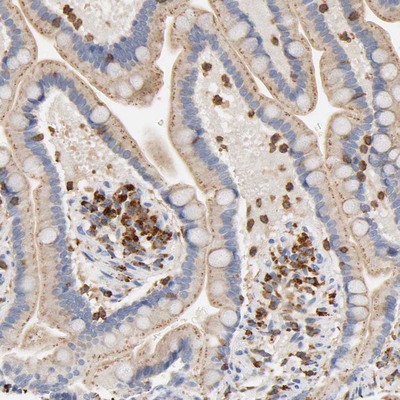Anti-UCKL1 Antibody
