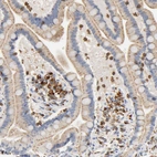 Anti-UCKL1 Antibody