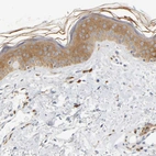 Immunohistochemical staining of human skin shows weak cytoplasmic positivity in squamous epithelial cells.
