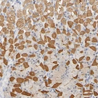 Immunohistochemical staining of human stomach shows moderate cytoplasmic positivity in parietal cells.
