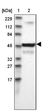 Lane 1: Marker [kDa] 229, 112, 84, 48, 32, 27, 17_br/_Lane 2: Human cell line RT-4