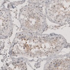 Anti-CT83 Antibody