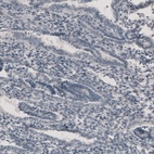 Anti-CT83 Antibody