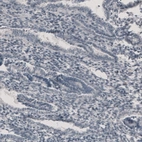 Immunohistochemical staining of human endometrium shows no positivity in glandular or stromal cells as expected.