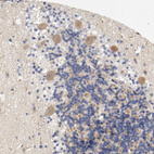 Anti-PCSK6 Antibody