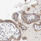 Immunohistochemical staining of human placenta shows moderate cytoplasm granular positivity in trophoblastic cells.