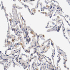 Anti-PCSK6 Antibody