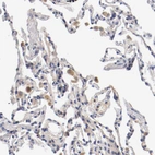 Immunohistochemical staining of human lung shows moderate cytoplasm granular positivity in macrophages.