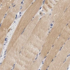 Immunohistochemical staining of human skeletal muscle shows moderate cytoplasmic positivity in myocytes.