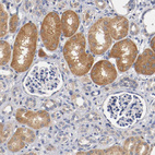 Anti-PCSK6 Antibody