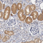 Immunohistochemical staining of human kidney shows moderate cytoplasm granular positivity in tubules.