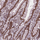 Anti-AKAP8 Antibody