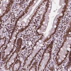 Immunohistochemical staining of human duodenum shows strong nuclear positivity in glandular cells and lymphoid cells.