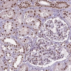 Immunohistochemical staining of human kidney shows strong nuclear positivity in cells in tubules and cells in glomeruli.
