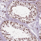 Immunohistochemical staining of human testis shows strong nuclear positivity in cells in seminiferous ducts.