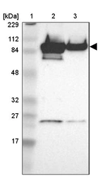 Lane 1: Marker [kDa] 229, 112, 84, 48, 32, 27, 17_br/_Lane 2: Human cell line RT-4_br/_Lane 3: Human cell line U-251MG sp