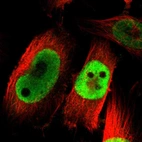 Immunofluorescent staining of human cell line U-251 MG shows localization to nucleoplasm.