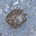 Anti-MCM3 Antibody