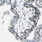 Anti-MCM3 Antibody