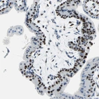 Immunohistochemical staining of human placenta shows strong nuclear positivity in trophoblastic cells.